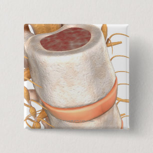 Close up of an invertebral disc in the spine 2 inch square button