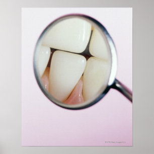 Close-up of teeth reflected in dental mirror poster