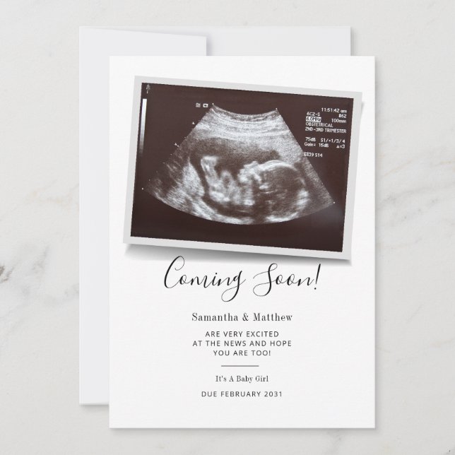 Coming Soon Script Ultrasound Sonogram Pregnancy Announcement (Front)