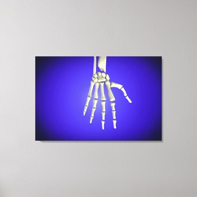 Conceptual Image Of Bones In Human Hand 2 Canvas Print (Front)