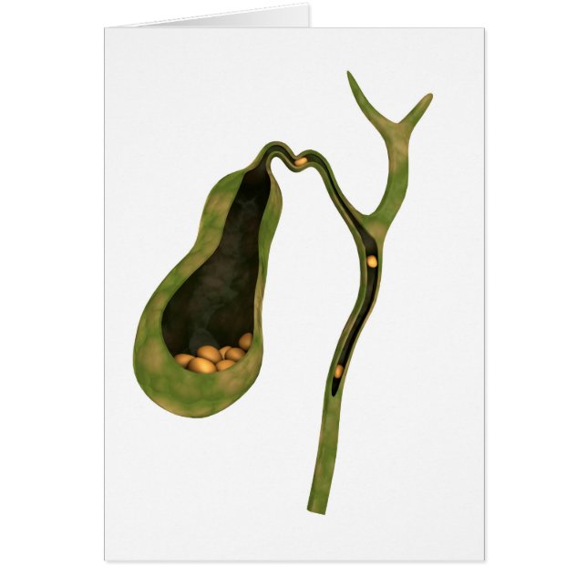 Conceptual Image Of Gallstones Inside Gall (Front)