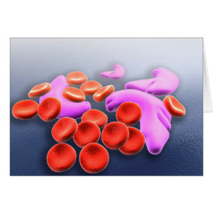 Conceptual Image Of Sickle Cell Anemia