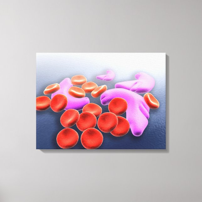 Conceptual Image Of Sickle Cell Anemia Canvas Print (Front)