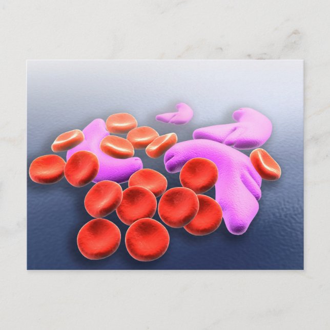 Conceptual Image Of Sickle Cell Anemia Postcard (Front)