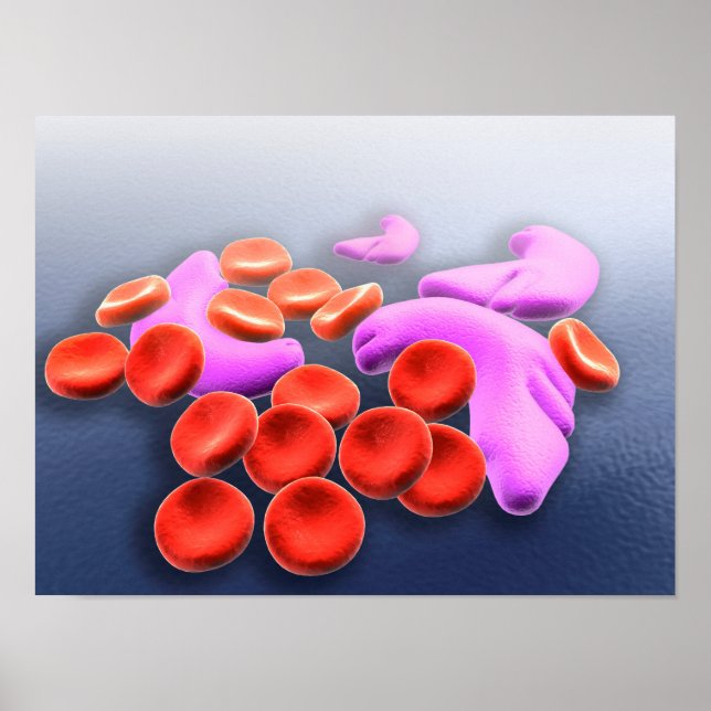 Conceptual Image Of Sickle Cell Anemia Poster (Front)