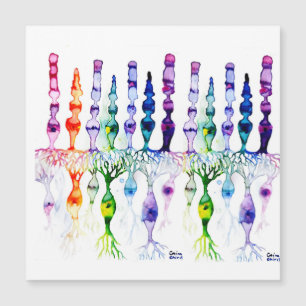 Cone cells rod cells and bipolar neurond of retina