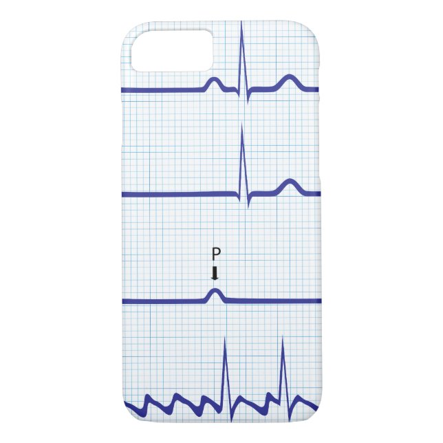 Coque iphone d'ECG/EKG (Dos)
