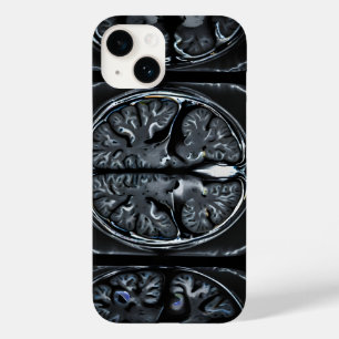 Coque Pour iPhone 14 Analyse cérébrale par IRM