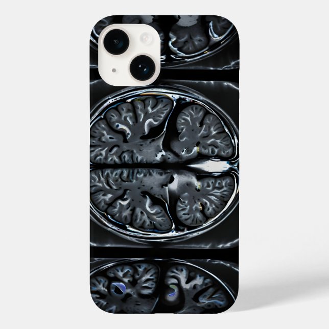 Coques Case-Mate iPhone Analyse cérébrale par IRM (Verso)