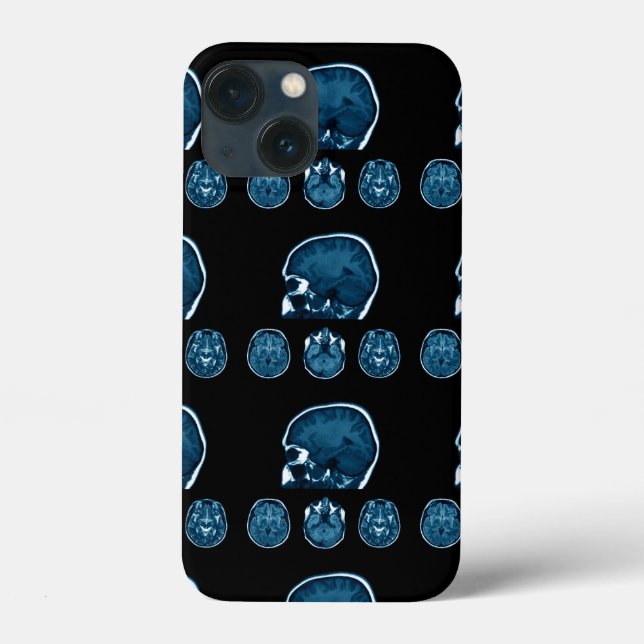 Coques Case-Mate iPhone Analyse Mri du cerveau (Verso)