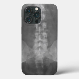 Coques Pour iPhone Art numérique X-Ray