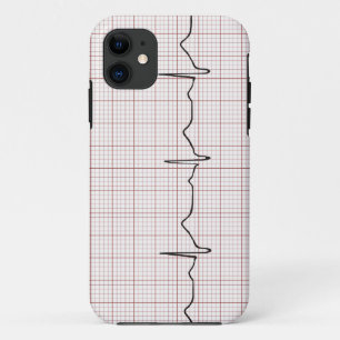 Coques Pour iPhone Battement de coeur d'ECG sur le papier de