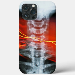 Coques Pour iPhone Boîtier de téléphone numérique X-Ray