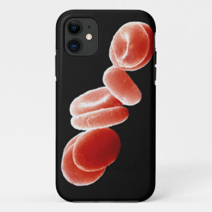 Coque iPhone 11 Globules rouges
