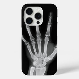 Coque iPhone 15 Pro Housse Skeleton iPhone 15 pro