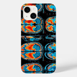 Coque Pour iPhone 14 IRM cérébrale