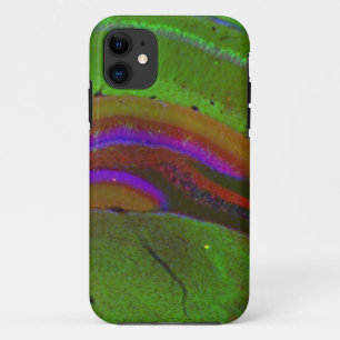 Coque iPhone 11 Neurones de Hippocampal