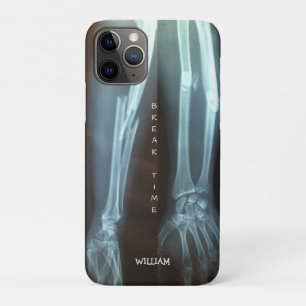 Case-Mate iPhone Case Rayon cassé et Ulna Xray "Temps de pause"   