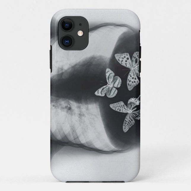 Coques Case-Mate iPhone Rayon X des papillons dans l'estomac (Dos)