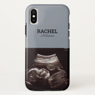 Case-Mate iPhone Case Ultrasound Photo Dusty Blue Monogramme