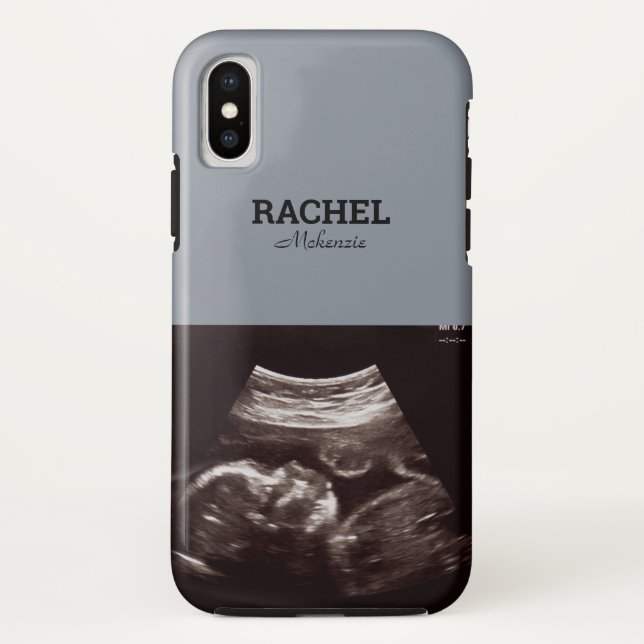 Coques Case-Mate iPhone Ultrasound Photo Dusty Blue Monogramme (Dos)