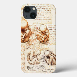 Etui iPhone Case-Mate Vues d'un foetus dans l'utérus, Ob-Gyn Médicale