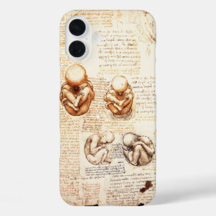 iPhone 16 Plus Case Vues d'un foetus dans l'utérus, Ob-Gyn Médicale