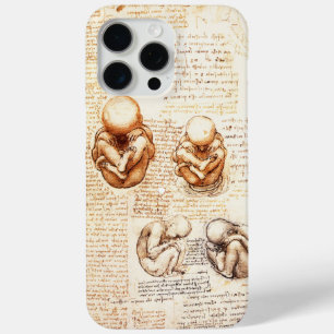 Coque iPhone 15 Pro Max Vues d'un foetus dans l'utérus, Ob-Gyn Médicale
