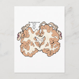 Cost an arm and a leg homunculus postcard