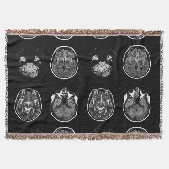 Couverture Analyse IRM du cerveau (Devant)