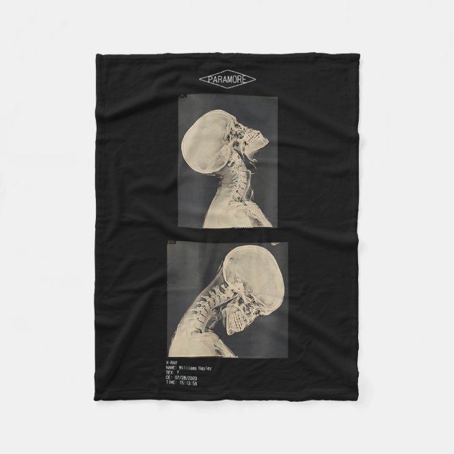 Cropped Headbanger X-Ray Doctors Fleece Blanket (Front)