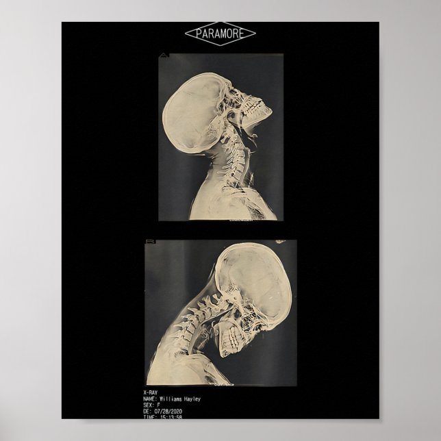 Cropped Headbanger X-Ray Doctors Poster (Front)