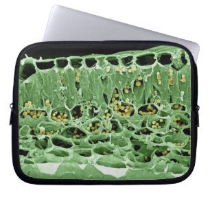 Cross Section of Leaf Laptop Sleeve