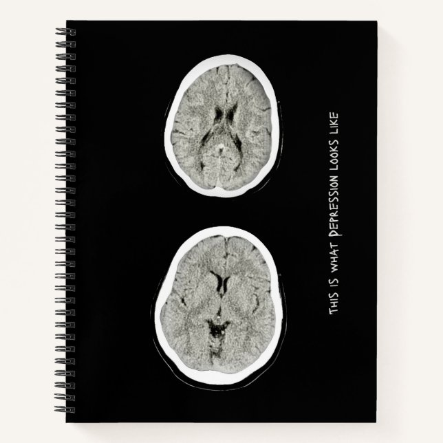 CT Scan_CTFOD_ This is what depression looks like  Notebook (Front)
