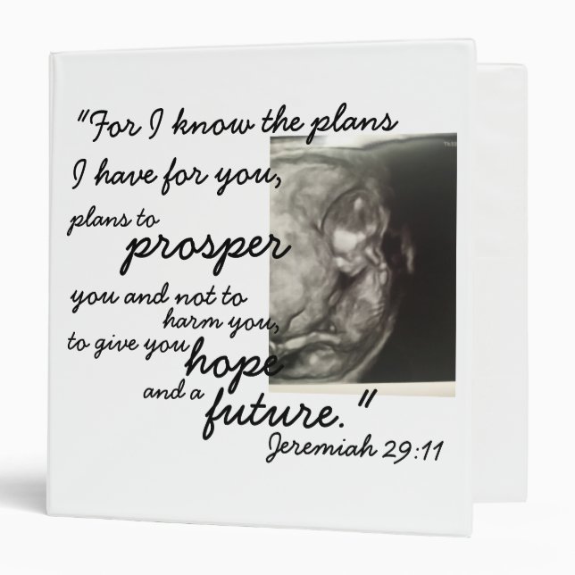 Custom Baby Book Personalized Photo Scrapbook Binder (Front/Inside)