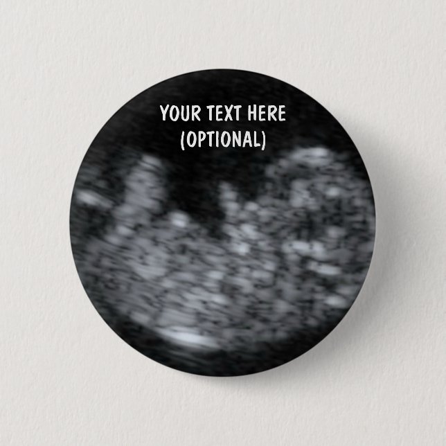 Custom Baby Ultrasound Picture 2 Inch Round Button (Front)