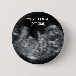 Custom Baby Ultrasound Picture 2 Inch Round Button