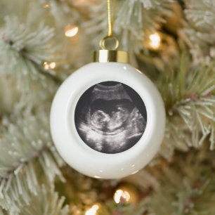 Custom Baby Ultrasound Pregnancy Announcment Photo Ceramic Ball Christmas Ornament