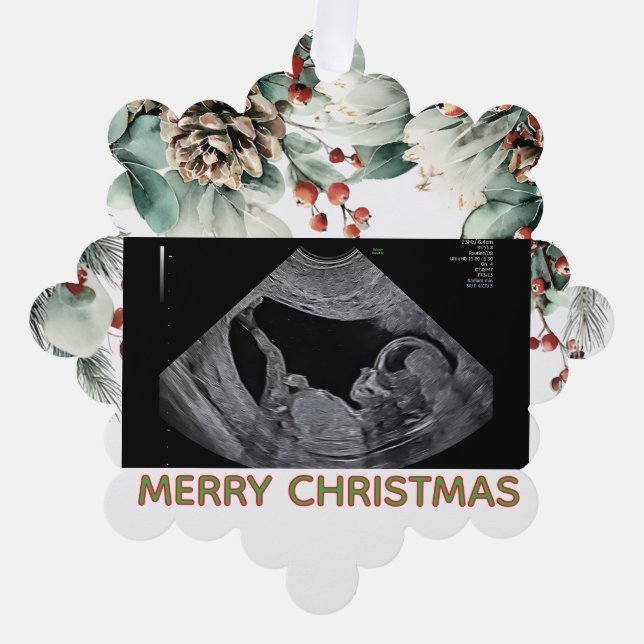 Custom First Christmas Expecting Photo Ornament (Front)