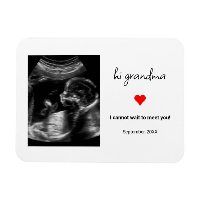 Custom Ultrasound Photo Gift For Grandma, Grandpa Magnet (Horizontal)