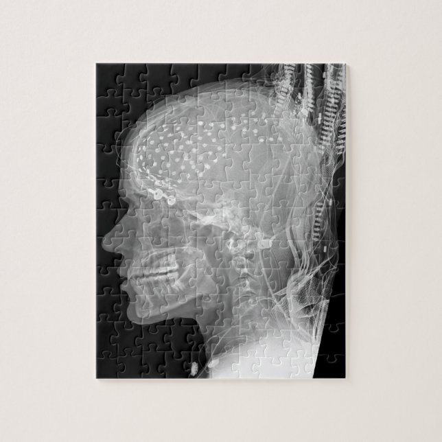 Cyborg de puzzle de rayon X (Vertical)