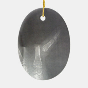 Décoration En Céramique Rayon X
