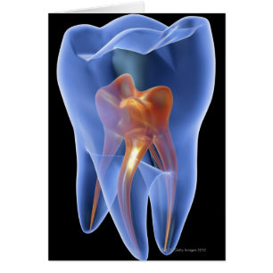 Dent, section transversale transparente d'une