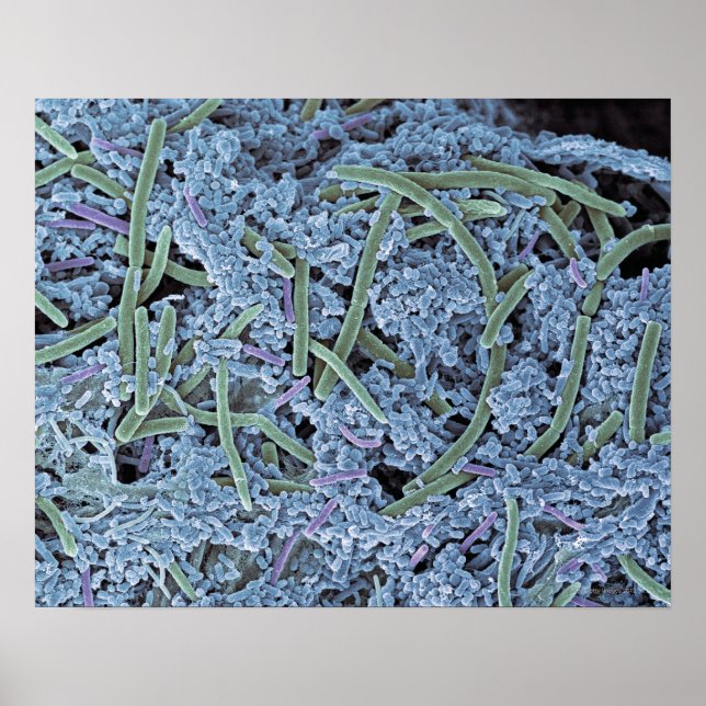 Dental plaque, colored scanning electron poster (Front)