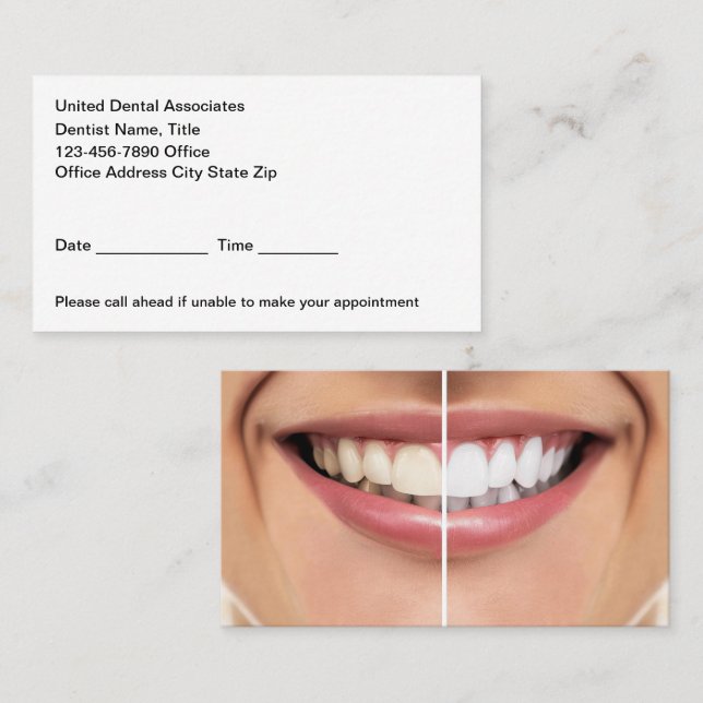 Dental Teeth Whitening Appointment Cards (Front/Back)