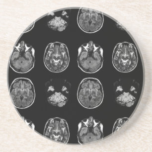 Dessous De Verre En Grès Analyse IRM du cerveau
