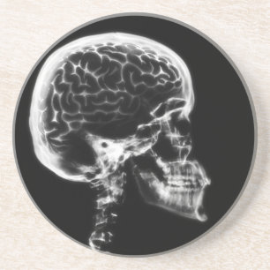 DESSOUS DE VERRE EN GRÈS CERVEAU-CIEL X-RAY - NOIR ET BLANC