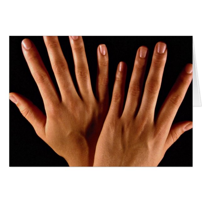 Deux mains croisées (Devant horizontal)