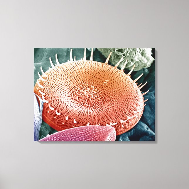 Diatom, a unicellular algae. canvas print (Front)
