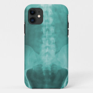 Digital X-Ray Art iPhone 5 Case